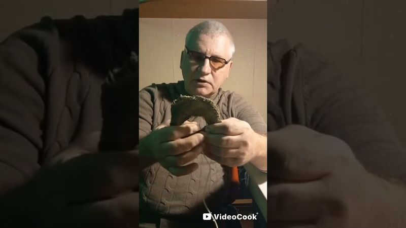 Лечение артроза подчелюстного сустава.