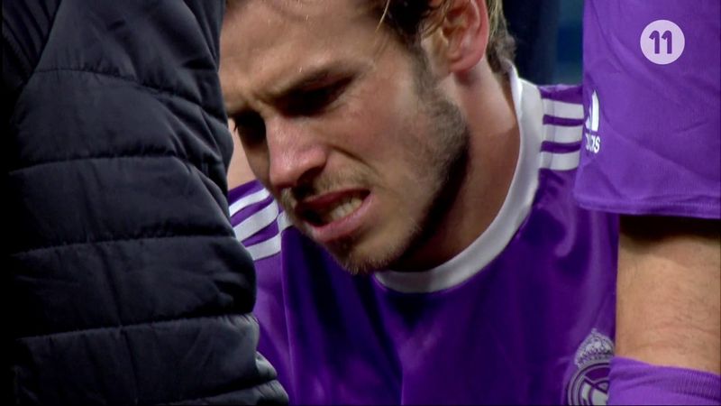 Champions League 23.11.2016 / Gareth Bale injury