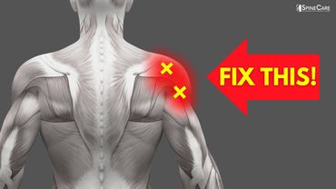 SOLUZIONE IN 30 SECONDI: Sollievo immediato dal dolore alla spalla