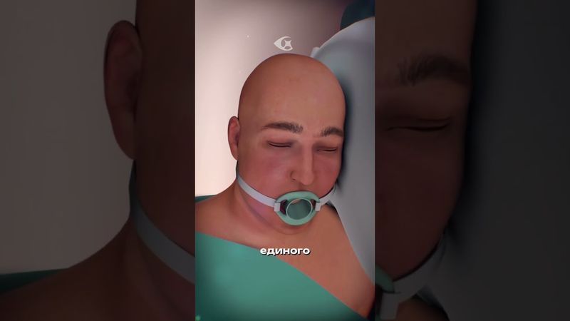 Как лечат кислотный рефлюкс? #биология #медицина #наука