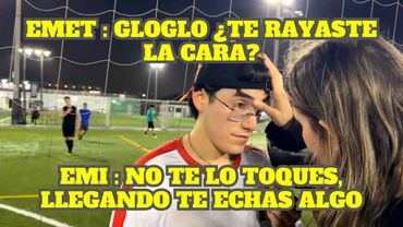 GLOGLO SE RAYA LA CARA Y EMET LE QUIERE PONER UNGUENTO DE SURI