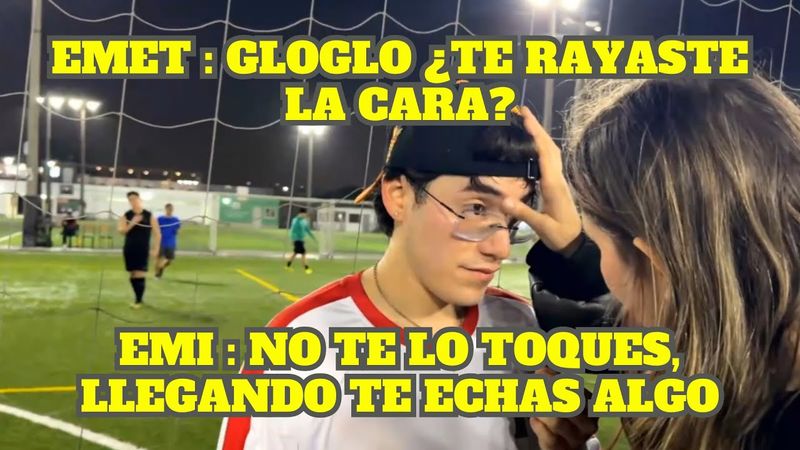 GLOGLO SE RAYA LA CARA Y EMET LE QUIERE PONER UNGUENTO DE SURI