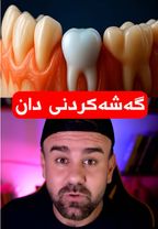 #japanese #doctor #teeth 