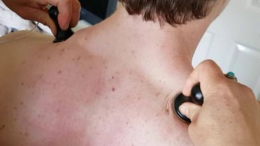 Example scenar treatment