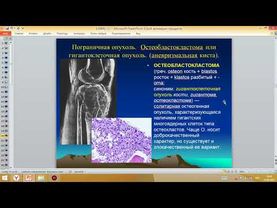 Опухоли костей и суставов