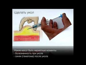 Как колоть золадекс самостоятельно.