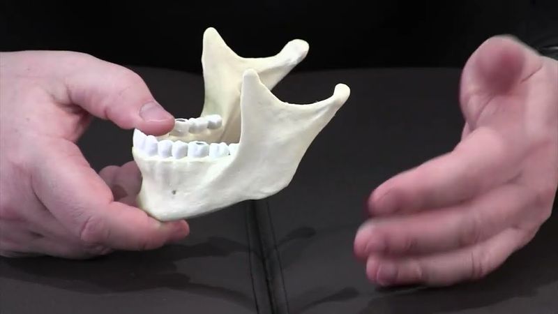 Лечение внутрикостных напряжений нижней челюсти