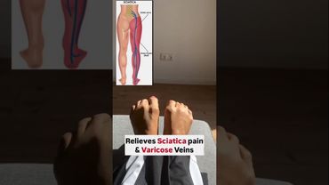 Relieve Sciatica pain, Back pain & Varicose veins ✅ #sciaticapainrelief #backpainrelief #yoga