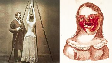 5 Creepy Ancient Medical Procedures (PART 2)