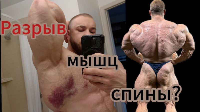 Травма . Первая тренировка спины