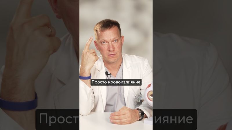 Первый ПРИЗНАК ИНСУЛЬТА в глазу – давление, которое убивает зрение