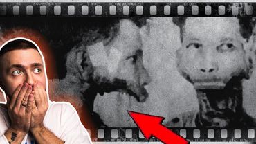 Від цих ліків ВІДПАДАЄ щелепа 🤯  Буквально! #СТРАШНЕ