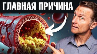 Лучшая пища для очищения сосудов!✅