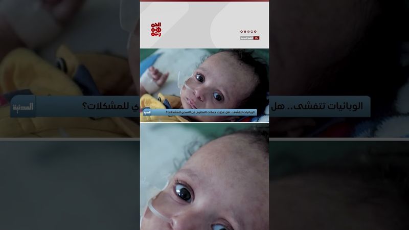 عجز التصدي يفاقم انتشار الحميات في اليمن | المدنية