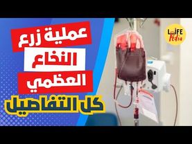 عملية زرع النخاع العضمي : أمل في الشفاء لمرضى السرطان وأمراض الدم