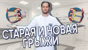 Отличия старой и новой грыжи | Что будет, если помешать выздоровлению |  Доктор Епифанов