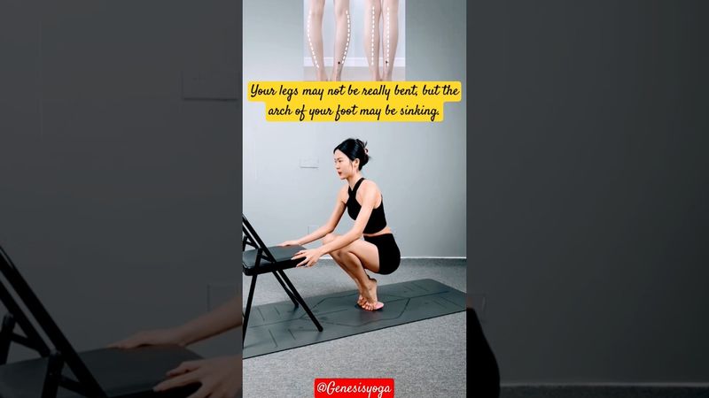 Your legs may not be really bent, but the arch of your foot may be sinking.#xo-shapedlegs #calfvalgu