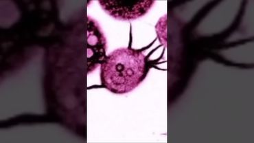 Щупальца иммунитета: как движется макрофаг