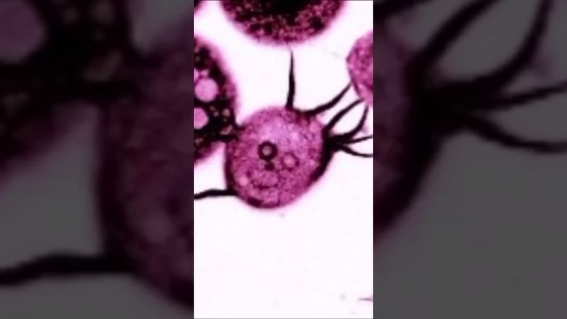 Щупальца иммунитета: как движется макрофаг