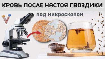 Как меняется кровь после употребления настоя гвоздики  самой гвоздики.
