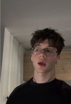 прыщ мне нащеку