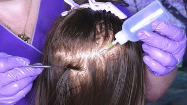 ASMR Scalp Check with Bad Results (Lice Check, Scalp Treatment, Scalp Massage) Medical Roleplay