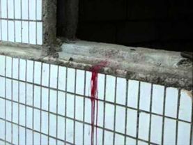 ХЗБ (Ховринская заброшенная больница)