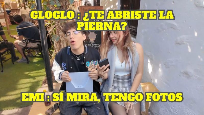 EMIKUKIS LE ENSEÑA A GLOGLO FOTOS DE SU ACCIDENTE EN MOTO
