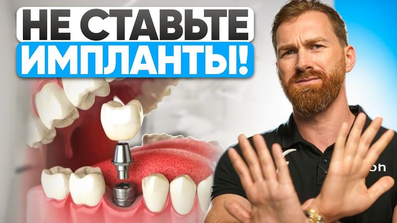 Вам НЕЛЬЗЯ ставить импланты! Стоматологи молчат об этом!