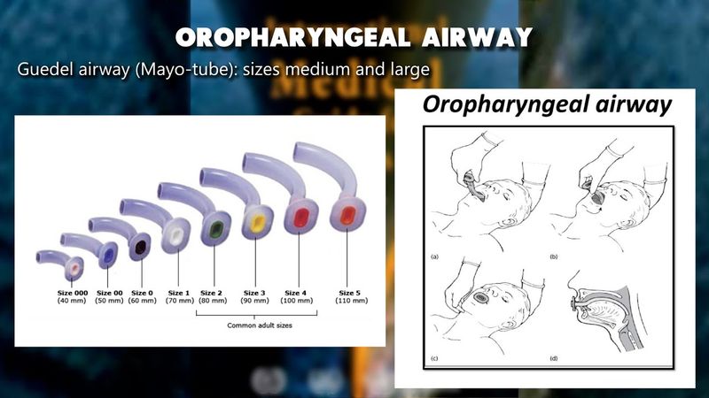 Ship's hospital. What medical equipment should be on board? | IMGS3 | UASUPPLY