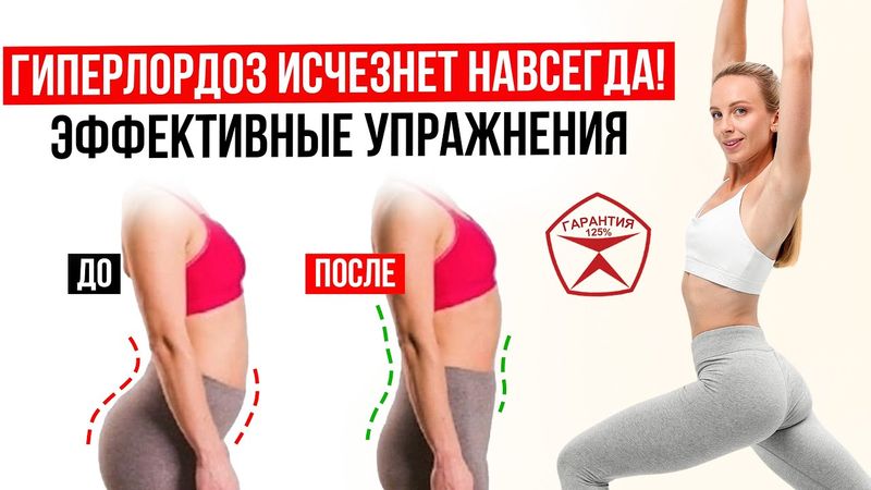 Тренировка от ГИПЕРЛОРДОЗА за 15 минут | Сделай СЕЙЧАС и Гиперлордоз исчезнет НАВСЕГДА!