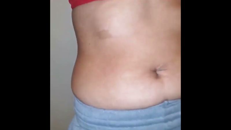 Worm 🪱 in bellybutton