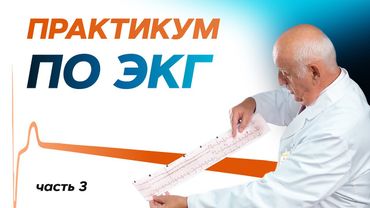 Практикум по ЭКГ с молодыми врачами. Часть 3. 09.02.22