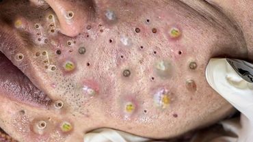 𝘼𝙘𝙝𝙞𝙚𝙫𝙚 𝙄𝙣𝙣𝙚𝙧 𝙋𝙚𝙖𝙘𝙚 𝙬𝙞𝙩𝙝 𝙏𝙝𝙚𝙨𝙚 𝙁𝙖𝙘𝙞𝙖𝙡 𝘾𝙡𝙚𝙖𝙣𝙨𝙞𝙣𝙜 𝙈𝙚𝙩𝙝𝙤𝙙𝙨 #77185