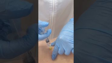 Протокол проведения липолитической процедуры по телу LipoLad Extra Strong