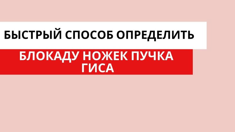 Как легко определить блокаду ножек пучка Гиса?