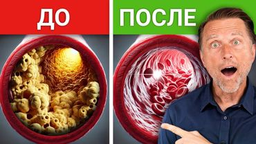 Еда, которая защищает от тромбов и инсульта🔥