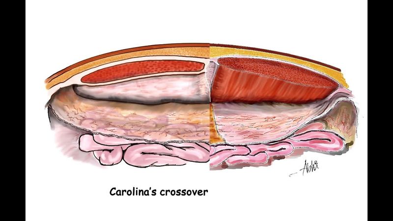 Carolina's eTEP Rives 2025