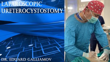 Laparoscopic ureterocystostomy / Лапароскопическая уретероцистонеостомия