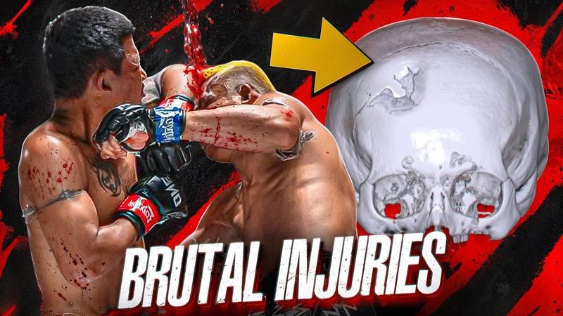 The most DISGUSTING MMA Video You’ll Ever Watch😳