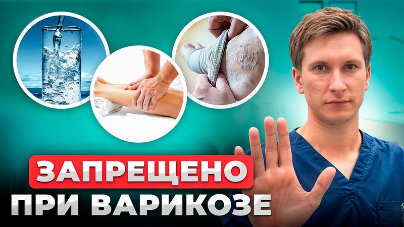 Что НЕЛЬЗЯ и Что МОЖНО при ВАРИКОЗЕ! Советы Флеболога