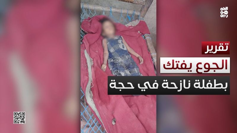 الجوع يخطف حياة طفلة في مخيم نزوح بحجة