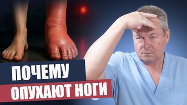 Отёки ног: главные причины и эффективные советы