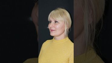 Омоложение лица с помощью эндоскопии: Результат через 3 месяца