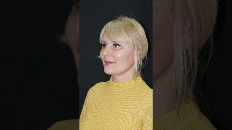 Омоложение лица с помощью эндоскопии: Результат через 3 месяца