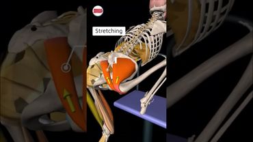 Синдром грушевидной мышцы