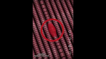 Тригерные точки зажимы мышц. Боли в Спине. Миопрессура #Массаж