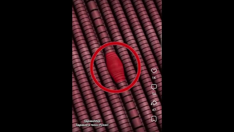 Тригерные точки зажимы мышц. Боли в Спине. Миопрессура #Массаж