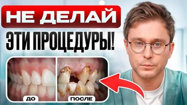 12 самых БЕСПОЛЕЗНЫХ процедур в стоматологии! Когда лечение у стоматолога НЕ нужно?