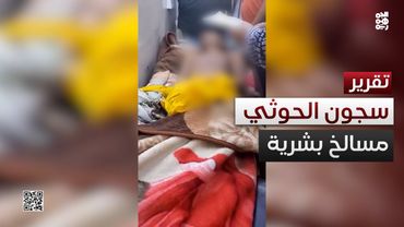 سجون الحوثي مسالخ بشرية